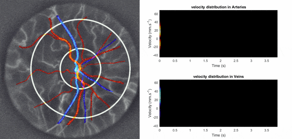 DopplerView vessel segmentation for Doppler holography