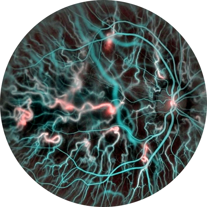 Doppler holography workflow